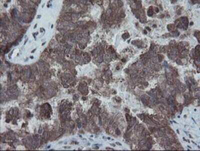 Immunohistochemistry-Paraffin: SnoN Antibody (OTI3E2) [NBP2-03881]