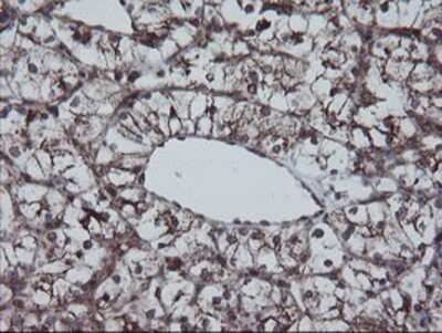 Immunohistochemistry-Paraffin: SnoN Antibody (OTI3E2) [NBP2-03881]