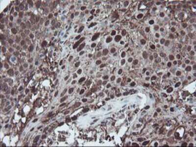 Immunohistochemistry-Paraffin: SnoN Antibody (OTI3E2) [NBP2-03881]