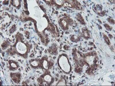 Immunohistochemistry-Paraffin: SnoN Antibody (OTI3E2) [NBP2-03881]