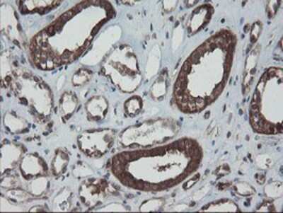 Immunohistochemistry-Paraffin: SnoN Antibody (OTI3E2) [NBP2-03881]