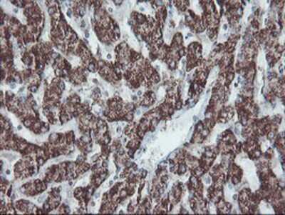 Immunohistochemistry-Paraffin: SnoN Antibody (OTI3E2) [NBP2-03881]