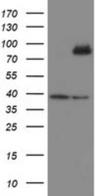 Western Blot: SnoN Antibody (OTI3E2) [NBP2-03881]