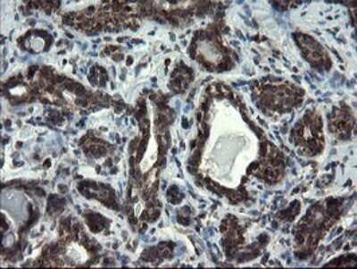Immunohistochemistry: SnoN Antibody (OTI3F6) [NBP2-45851]