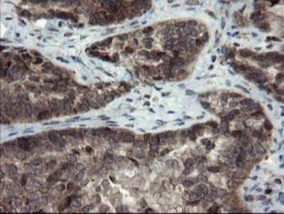 Immunohistochemistry: SnoN Antibody (OTI3F6) [NBP2-45851]