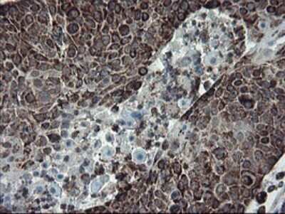 Immunohistochemistry: SnoN Antibody (OTI3F6) [NBP2-45851]
