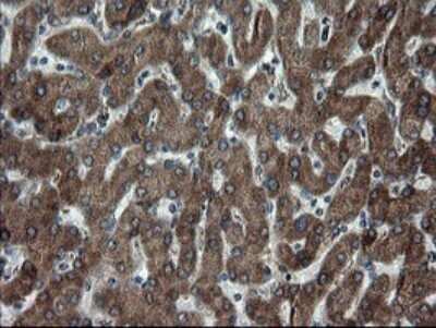 Immunohistochemistry: SnoN Antibody (OTI3F6) [NBP2-45851]