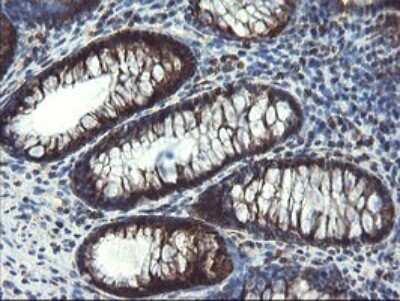 Immunohistochemistry: SnoN Antibody (OTI3F6) [NBP2-45851]
