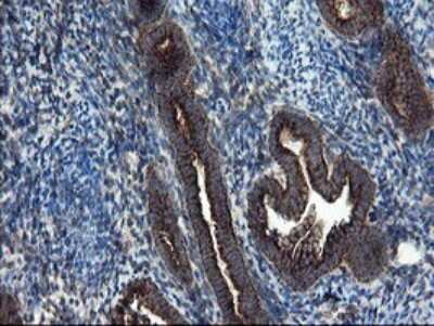 Immunohistochemistry: SnoN Antibody (OTI3F6) [NBP2-45851]