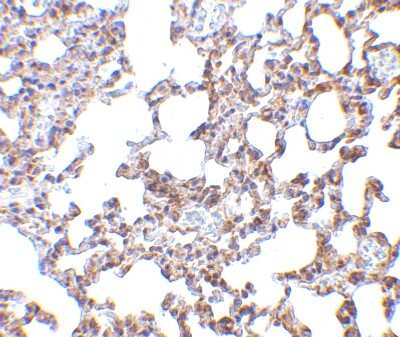 Immunohistochemistry-Paraffin: SnoN Antibody - BSA Free [NBP1-77306]