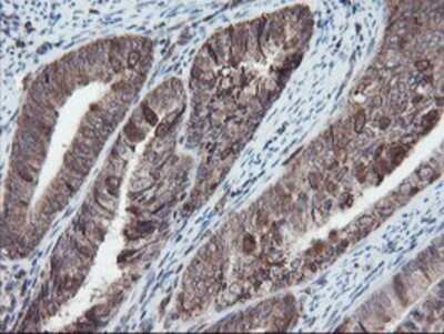 Immunohistochemistry: SnoN Antibody (OTI3E2) - Azide and BSA Free [NBP2-74255]