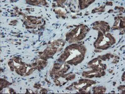 Immunohistochemistry: SnoN Antibody (OTI3E2) - Azide and BSA Free [NBP2-74255]