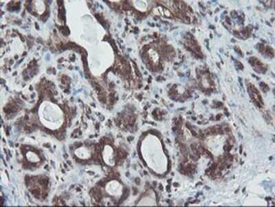 Immunohistochemistry: SnoN Antibody (OTI3E2) - Azide and BSA Free [NBP2-74255]
