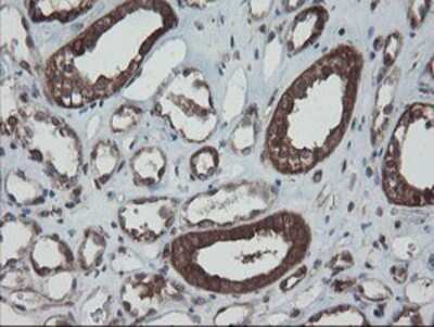 Immunohistochemistry: SnoN Antibody (OTI3E2) - Azide and BSA Free [NBP2-74255]