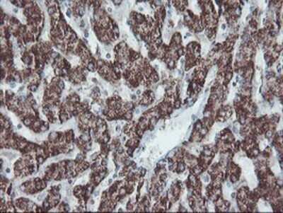 Immunohistochemistry: SnoN Antibody (OTI3E2) - Azide and BSA Free [NBP2-74255]