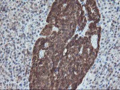 Immunohistochemistry: SnoN Antibody (OTI3E2) - Azide and BSA Free [NBP2-74255]