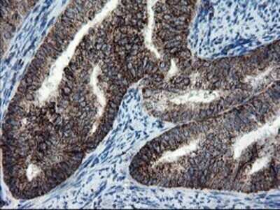 Immunohistochemistry: SnoN Antibody (OTI3F6) - Azide and BSA Free [NBP2-74254]