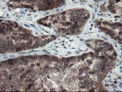 Immunohistochemistry: SnoN Antibody (OTI3F6) - Azide and BSA Free [NBP2-74254]