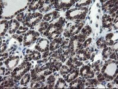 Immunohistochemistry: SnoN Antibody (OTI3F6) - Azide and BSA Free [NBP2-74254]