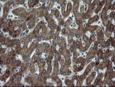 Immunohistochemistry: SnoN Antibody (OTI3F6) - Azide and BSA Free [NBP2-74254]
