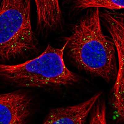 Immunocytochemistry/ Immunofluorescence: Snx6 Antibody [NBP2-13361]