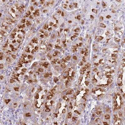 Immunohistochemistry-Paraffin: Snx6 Antibody [NBP2-13361]