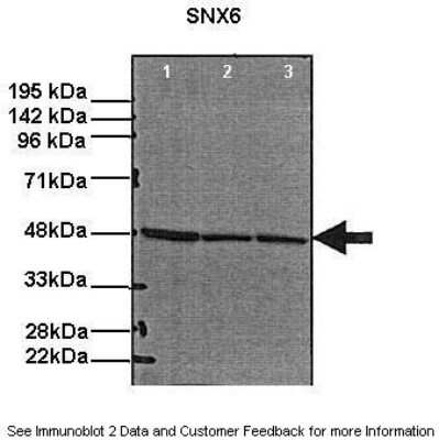 Western Blot: Snx6 Antibody [NBP1-98504]