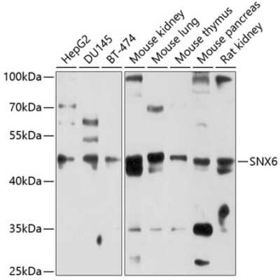 Western Blot: Snx6 AntibodyBSA Free [NBP2-94535]