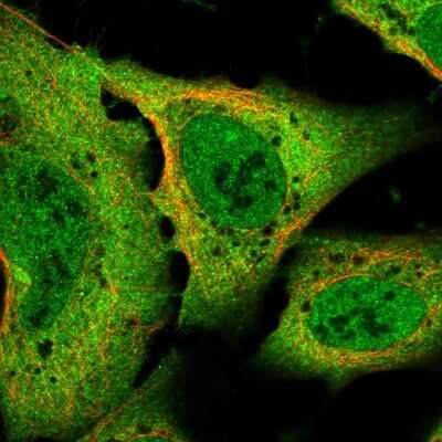 Immunocytochemistry/ Immunofluorescence: Sodium Calcium Exchanger 1/NCX1 Antibody [NBP2-56483]