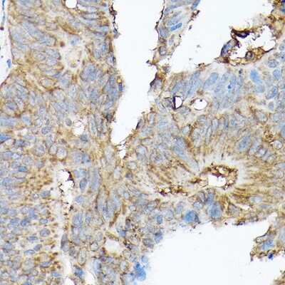Immunohistochemistry-Paraffin: Sodium Calcium Exchanger 1/NCX1 Antibody - Azide and BSA Free [NBP2-94316]