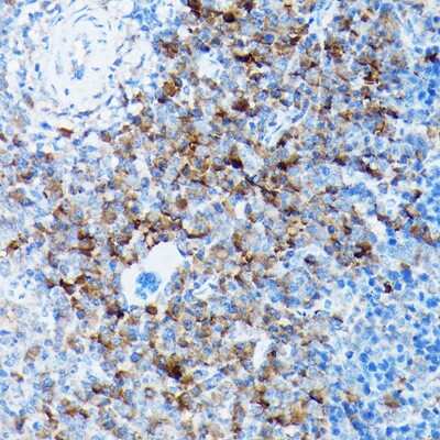 Immunohistochemistry-Paraffin: Sodium Calcium Exchanger 1/NCX1 Antibody - Azide and BSA Free [NBP2-94316]