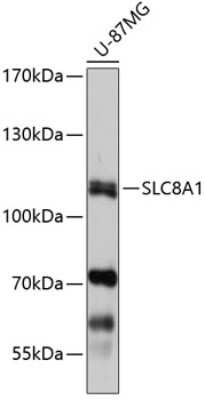 Western Blot: Sodium Calcium Exchanger 1/NCX1 AntibodyAzide and BSA Free [NBP2-93088]