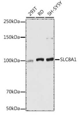 Western Blot: Sodium Calcium Exchanger 1/NCX1 AntibodyAzide and BSA Free [NBP2-94316]