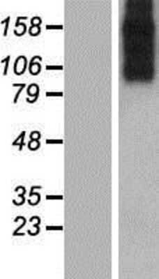 Western Blot: SLC8A3/NCX3 Overexpression Lysate [NBP2-05794]