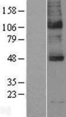 Western Blot: SLC5A5/Sodium Iodide Symporter Overexpression Lysate [NBP2-04158]