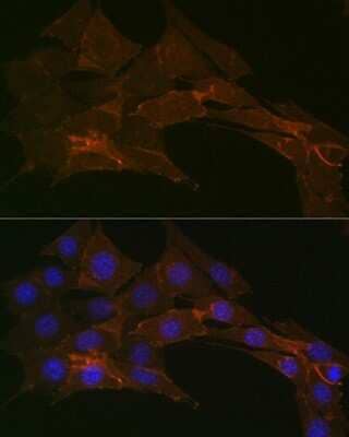 Immunocytochemistry/ Immunofluorescence: Sodium Potassium ATPase Alpha 1 Antibody (3L6F0) [NBP3-15427]