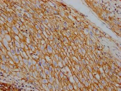 Immunohistochemistry: Sodium Potassium ATPase Alpha 1 Antibody (4C3) [NBP3-15239]