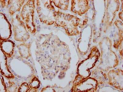 Immunohistochemistry: Sodium Potassium ATPase Alpha 1 Antibody (4C3) [NBP3-15239]
