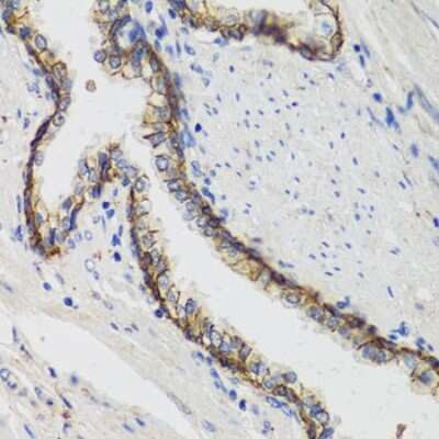 Immunohistochemistry-Paraffin: Sodium Potassium ATPase Alpha 1 Antibody - BSA Free [NBP2-95089]