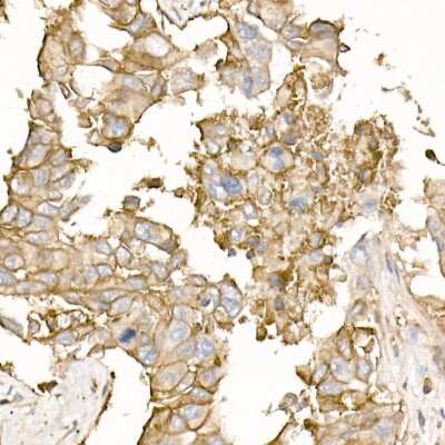 Immunohistochemistry-Paraffin: Sodium Potassium ATPase Alpha 1 Antibody - Azide and BSA Free [NBP2-95255]