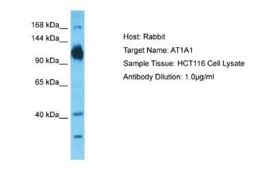 Western Blot: Sodium Potassium ATPase Alpha 1 Antibody [NBP2-84601]