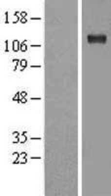 Western Blot: Sodium Potassium ATPase Alpha 1 Overexpression Lysate [NBL1-07807]