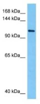 Western Blot: Sodium Potassium ATPase Alpha 2 Antibody [NBP3-10276]