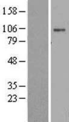 Western Blot: Sodium Potassium ATPase Alpha 2 Overexpression Lysate [NBL1-07808]