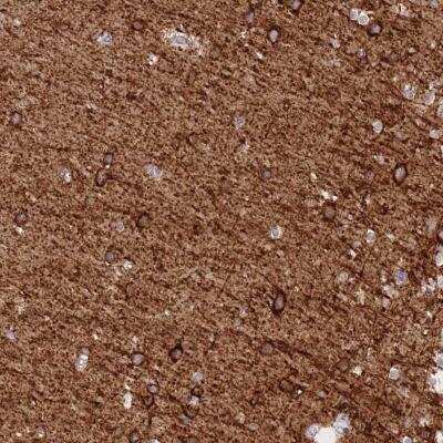 Immunohistochemistry-Paraffin: Sodium Potassium ATPase Alpha 3 Antibody [NBP2-37913]