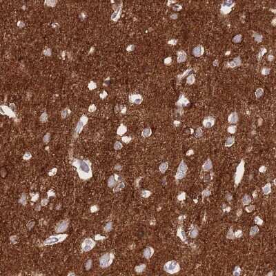Immunohistochemistry-Paraffin: Sodium Potassium ATPase Alpha 3 Antibody [NBP2-37913]
