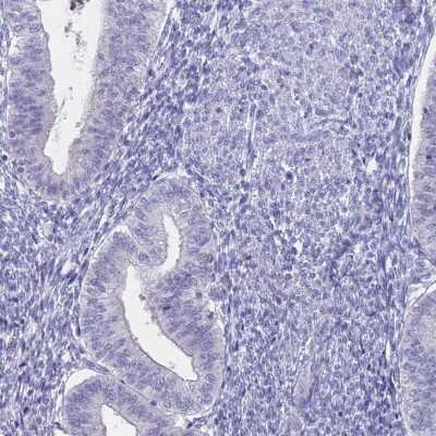 Immunohistochemistry-Paraffin: Sodium Potassium ATPase Alpha 3 Antibody [NBP2-37913]