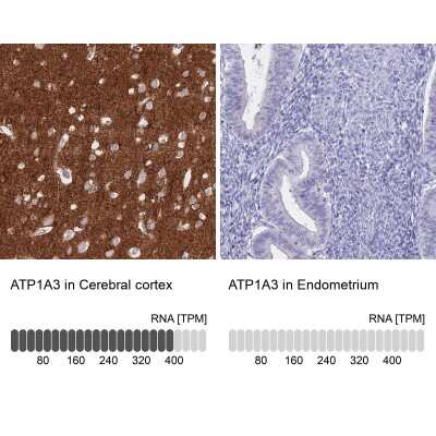 Immunohistochemistry-Paraffin: Sodium Potassium ATPase Alpha 3 Antibody [NBP2-37913]