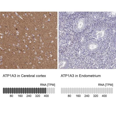 Immunohistochemistry-Paraffin: Sodium Potassium ATPase Alpha 3 Antibody [NBP2-37955]