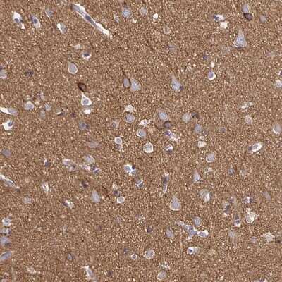 Immunohistochemistry-Paraffin: Sodium Potassium ATPase Alpha 3 Antibody [NBP2-37955]